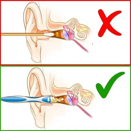 Tvidler Review 2021: Does this Ear wax cleaner actually work or just hyping? 6 Working Mechanism of Tvidler 2