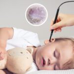 Best Earwax Removal 2022: Top ear wax cleaner in 2022