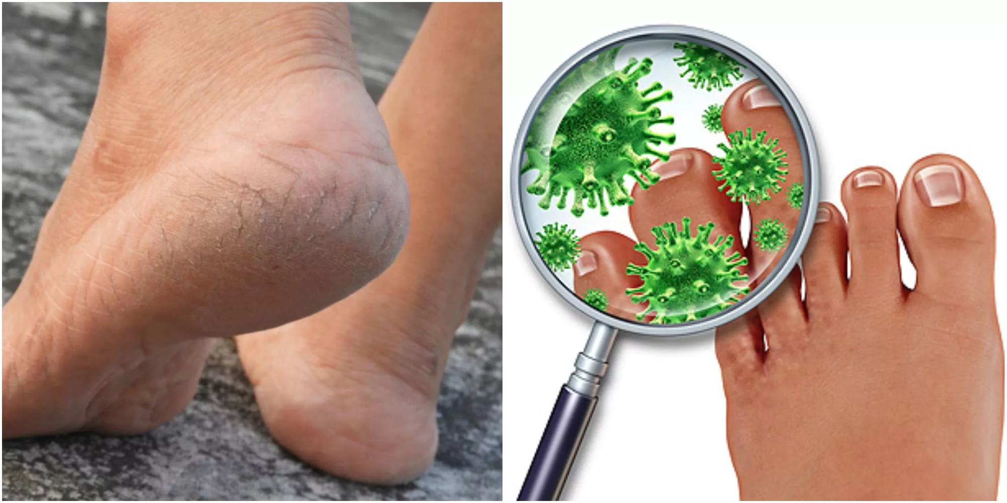 Melzu foot peel mask Reviews 2023: Does This Foot Meel Mask Work? 12 Melzu foot peel mask Reviews