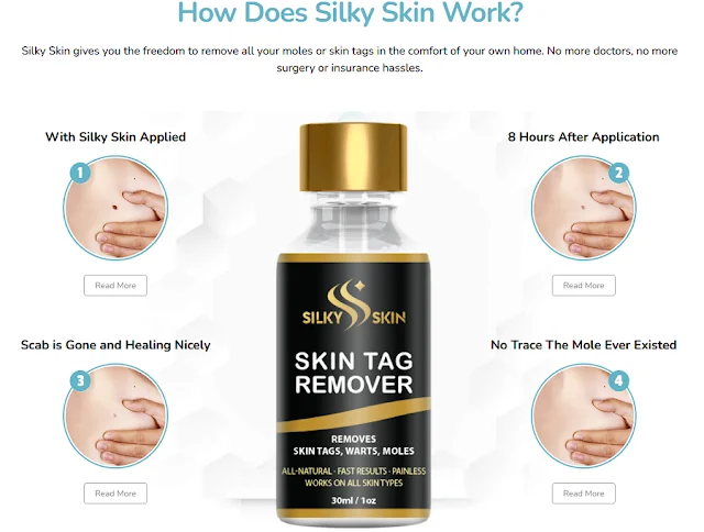 Silky Skin Tag Remover Reviews