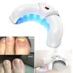 Fungabeam Nail Fungus Light Review – Does It Really Work to Eliminate Toenail Fungus Fast?