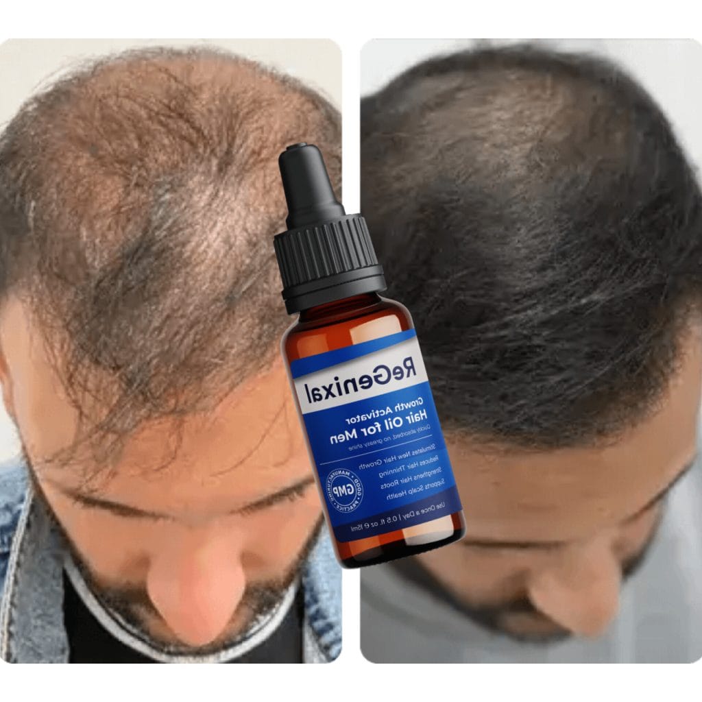 ReGenixal Growth Activator Hair Oil Review: Users Experience United States 5 ReGenixal Growth Activator Hair Oil Review
