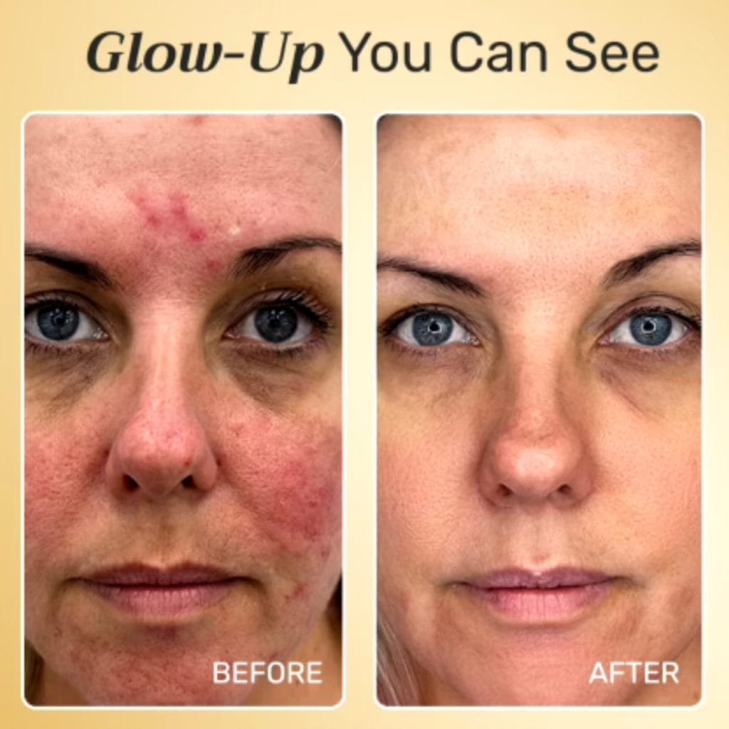 NuroDerma Red Light Mask 