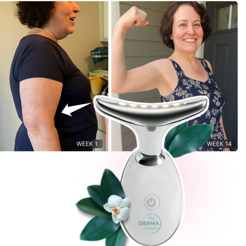 MyoGlow Flabby Arms Reviews